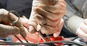 в сердобске обвинили хирурга в убийстве пациента - Сайт Газеты «Совершенно Секретно»