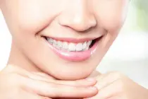 В Китае создали восстанавливающий эмаль зубов гель