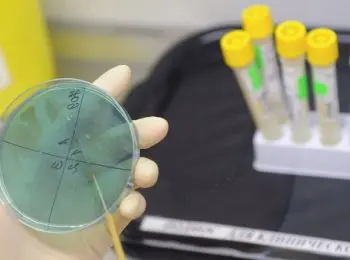 в европе зафиксирована вспышка опасной инфекции - Сайт Газеты «Совершенно Секретно»