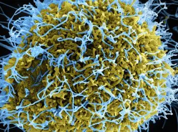 заразившийся эболой американец контактировал с сотнями людей - Сайт Газеты «Совершенно Секретно»