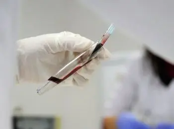 роспотребнадзор: из отпусков россияне могут привезти коронавирус - Сайт Газеты «Совершенно Секретно»