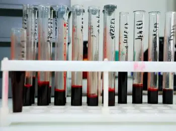 минюст проверит нко на пропаганду метадоновой терапии - Сайт Газеты «Совершенно Секретно»