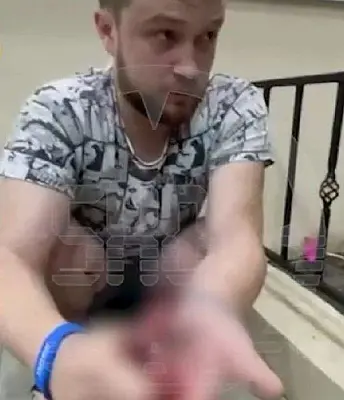 под анапой турист выстрелом из травмата лишил двух пальцев постояльца отеля (видео) - Сайт Газеты «Совершенно Секретно»