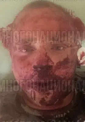 в смоленске из-за девушки армяне избили и расстреляли из травмата участника сво (видео) - Сайт Газеты «Совершенно Секретно»