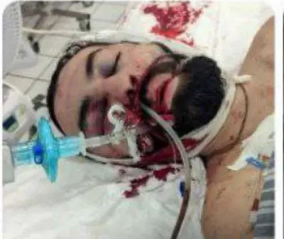 жена раненного в голову командира милиции лнр считает, что её мужа пытались казнить (видео) - Сайт Газеты «Совершенно Секретно»