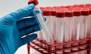 С 15 мая родственники пропавших начнут сдавать ДНК