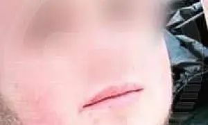 Один человек погиб: житель Томской области случайно взорвал гранату, думая, что это муляж