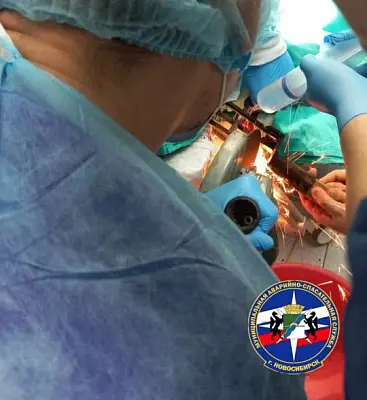 мужчина с вилами в голове будет жить - Сайт Газеты «Совершенно Секретно»