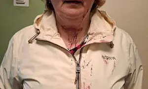 После избиения мигрантами экс-следователя в Красном Селе возбуждено уголовное дело. СК проверяет работу полиции