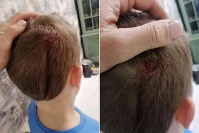 неизвестный выстрелил ребёнку в голову в смоленске - Сайт Газеты «Совершенно Секретно»