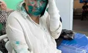 В Чечне жестоко избили журналистку  “Новой газеты” Елену Милашину и адвоката Александра Немова