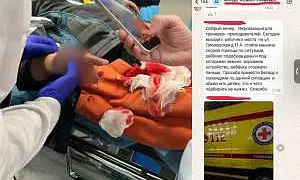 В Подмосковье 9-летний мальчик лишился пальцев, подняв «купюру» со взрывчаткой