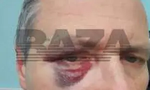 В Подмосковье семья умершего пациента избила врачей, обвиняя медиков в убийстве