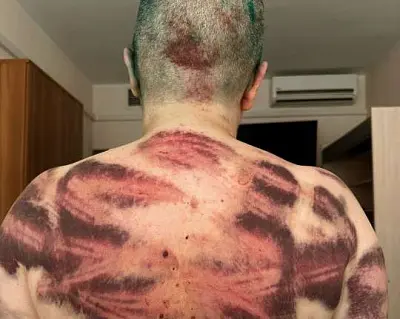 почти 40 часов прошло с жестокого нападения на милашину и немова до возбуждения уголовного дела - Сайт Газеты «Совершенно Секретно»