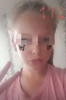 в приангарье семиклассница осталась без рук после взрыва зарядки от телефона - Сайт Газеты «Совершенно Секретно»