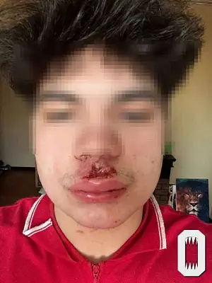 в питере банда подростков напала на прохожего, потому что он не стал отдавать куртку - Сайт Газеты «Совершенно Секретно»