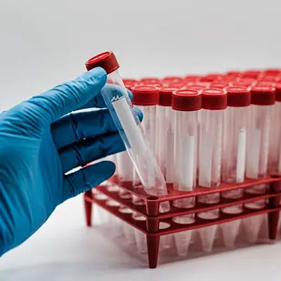 с 15 мая родственники пропавших начнут сдавать днк - Сайт Газеты «Совершенно Секретно»