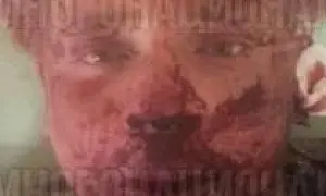 В Смоленске из-за девушки армяне избили и расстреляли из травмата участника СВО (ВИДЕО)