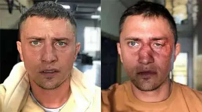 бизнесмен, повредивший череп актёра прилучного, получил 1 год и 5 месяцев исправительных работ - Сайт Газеты «Совершенно Секретно»