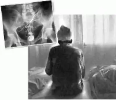 ВРАЧЕБНАЯ ОШИБКА - Совершенно Секретно