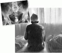 ВРАЧЕБНАЯ ОШИБКА