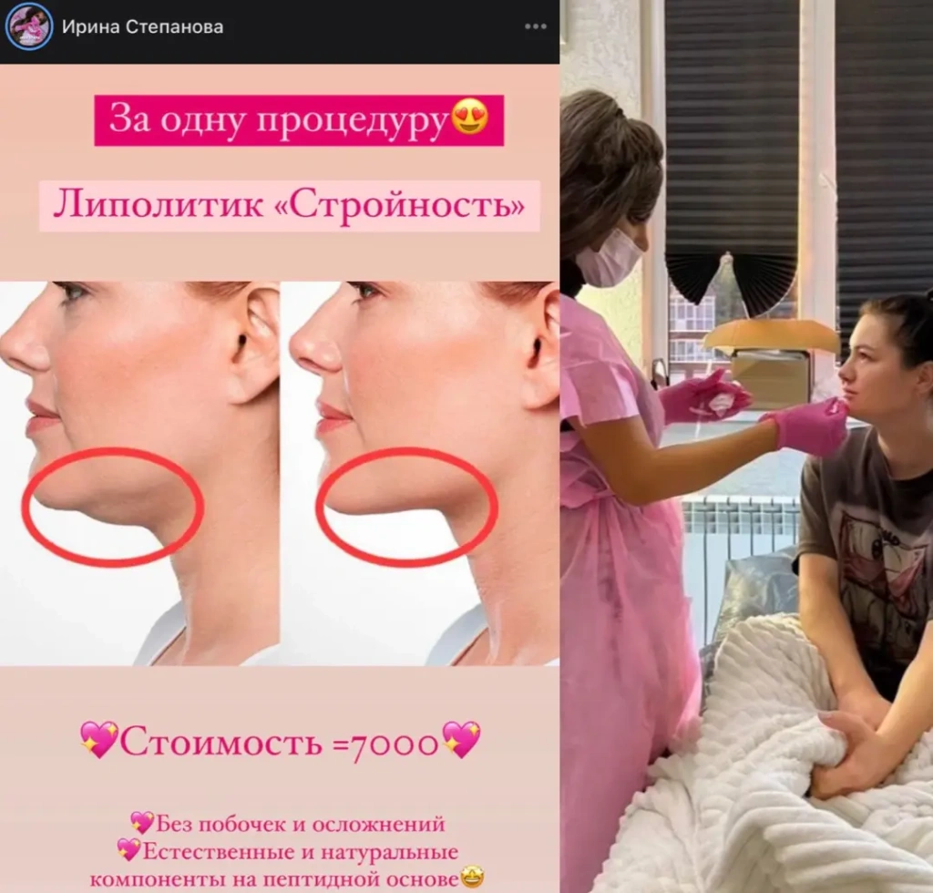 препараты и кадры проведения инъекционных процедур