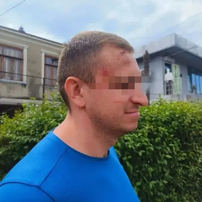 в абхазии водители экскурсионных джипов и сотрудники общепита жестоко избили группу российских туристов   - Сайт Газеты «Совершенно Секретно»