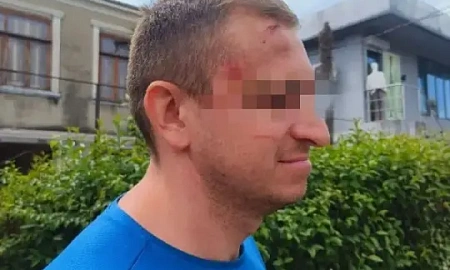 В Абхазии водители экскурсионных джипов и сотрудники общепита жестоко избили группу российских туристов  