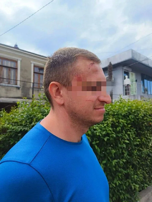 в абхазии водители экскурсионных джипов и сотрудники общепита жестоко избили группу российских туристов   - Сайт Газеты «Совершенно Секретно»