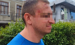 В Абхазии водители экскурсионных джипов и сотрудники общепита жестоко избили группу российских туристов  